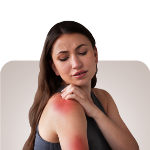Category Itchy & Irritated Skin image